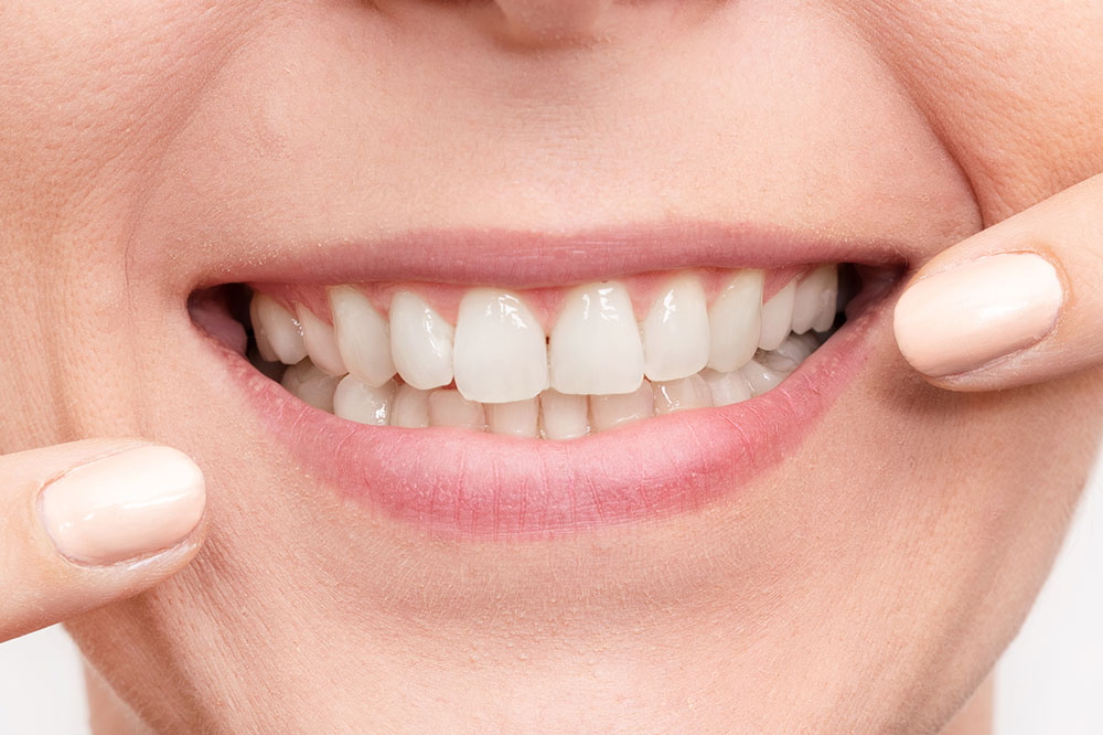 Easy and Natural Ways to Whiten Teeth at Home